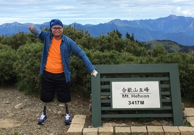 八仙塵燃後截四肢保命 難忘被鼓勵：至少你還在