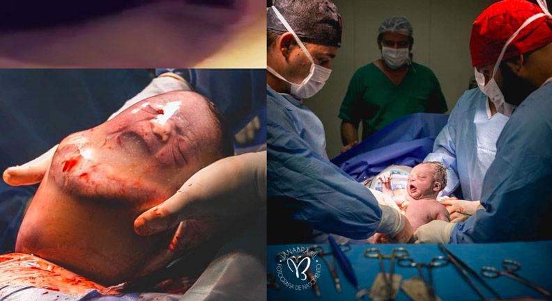 這是你我曾經的模樣...十萬分之一的機率他就這樣出生了_img_1