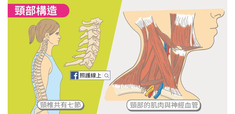 脖子痛是中風前兆？先別慌，這 6 種情況儘早檢查_img_1
