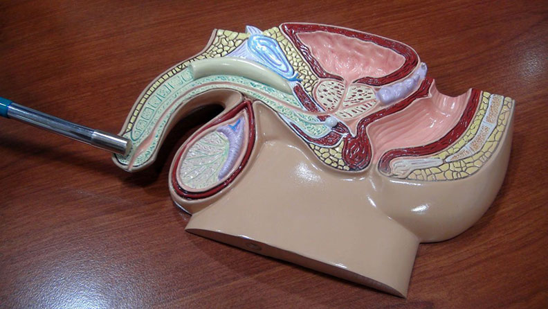 攝護腺炎反覆發作?原來女伴分泌物顏色是關鍵_img_1