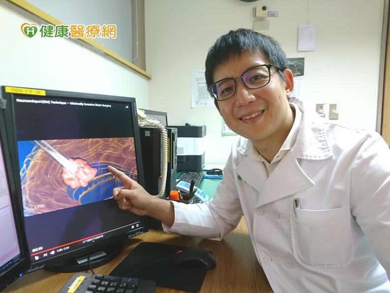 未有病史卻癲癇發作,竟是腦出血惹禍!_img_1