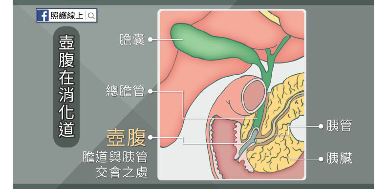 李應元、幸佳慧都因「壺腹癌」病逝!出現腹痛、大便灰白6症狀須留意_img_1