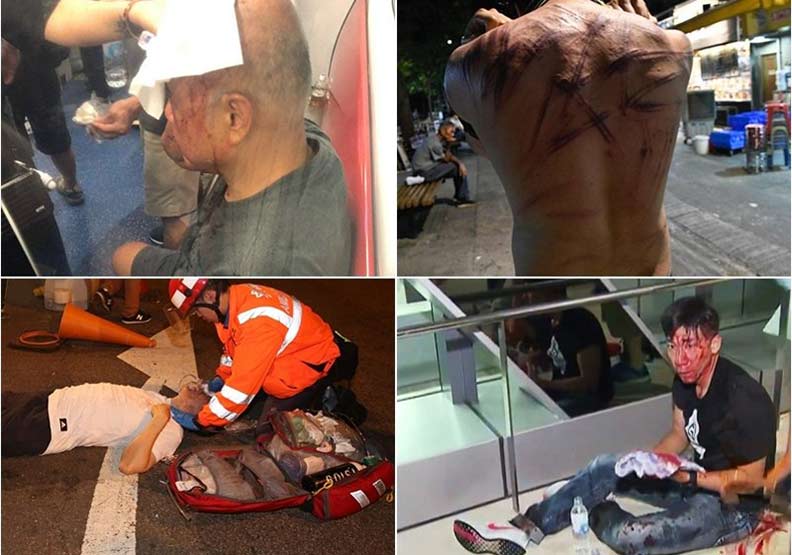 香港元朗暴力事件造成至少36人受傷送院。星島網
