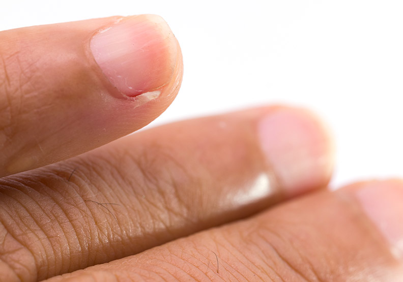 剪指甲學問大,中壯年、銀髮族修剪方式大不同!_img_1