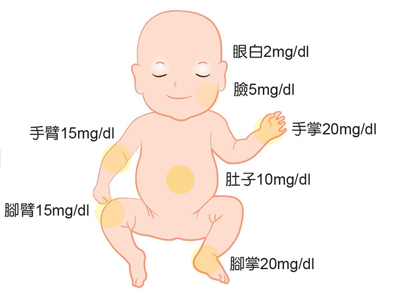 新手父母不要慌,寶寶黃疸問題婦產科醫師來分析_img_3