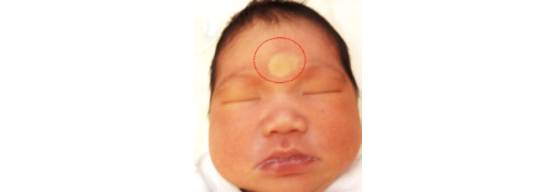 新手父母不要慌,寶寶黃疸問題婦產科醫師來分析_img_1