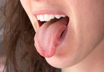 這 3 種情況會讓舌頭「長痣」，醫：發現變大快就醫