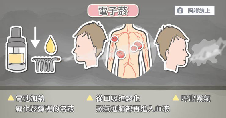 電子菸有助戒菸嗎?美國上百位青少年使用後呼吸衰竭住院_img_1
