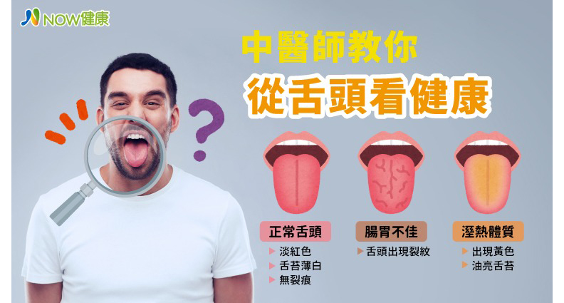 我適合喝咖啡嗎?中醫教你從舌頭一眼辨別體質_img_1