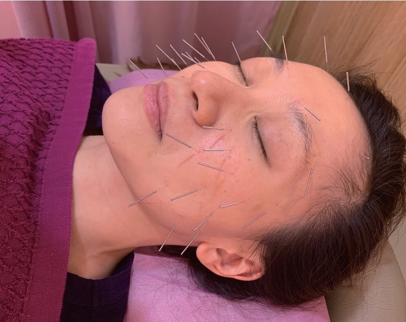 30歲後黑斑、細紋跟著來,中醫「匿齡保養術」先準備好_img_2