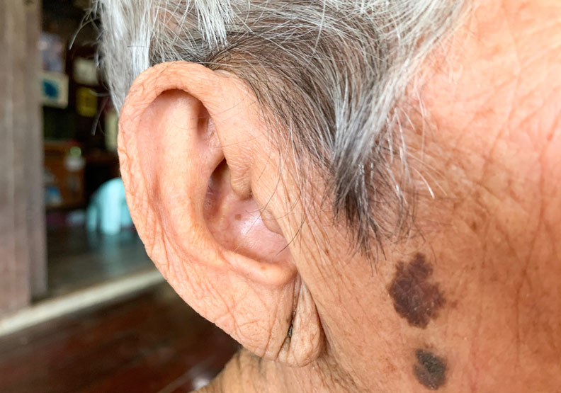 耳垂出現摺痕在醫學上稱之為「冠心溝」。僅為情境配圖,取自shutterstock