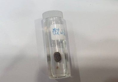 台史上首例SFTS傳染病！戶外活動小心被這種蟲叮咬