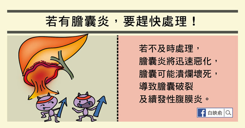 嘔吐發燒又腹痛，膽囊炎發作一定要開刀嗎？_img_5