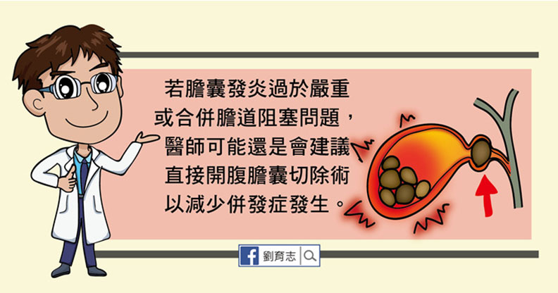 嘔吐發燒又腹痛，膽囊炎發作一定要開刀嗎？_img_8