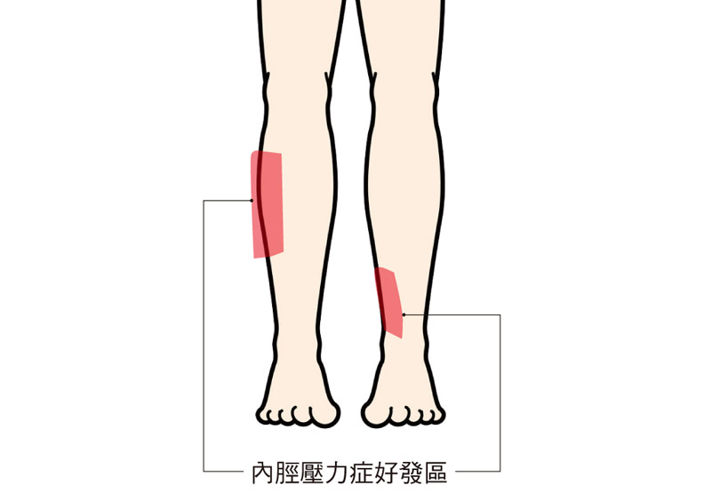 運動完隔天腿部好痠痛...「鐵腿」的成因與緩解方式_img_2