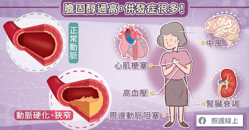 「高血脂症」不可不知,關於膽固醇的 4 大錯誤迷思!_img_1