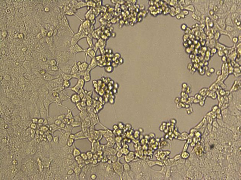 早期出現病變的vero-E6傳代細胞。取自人民網