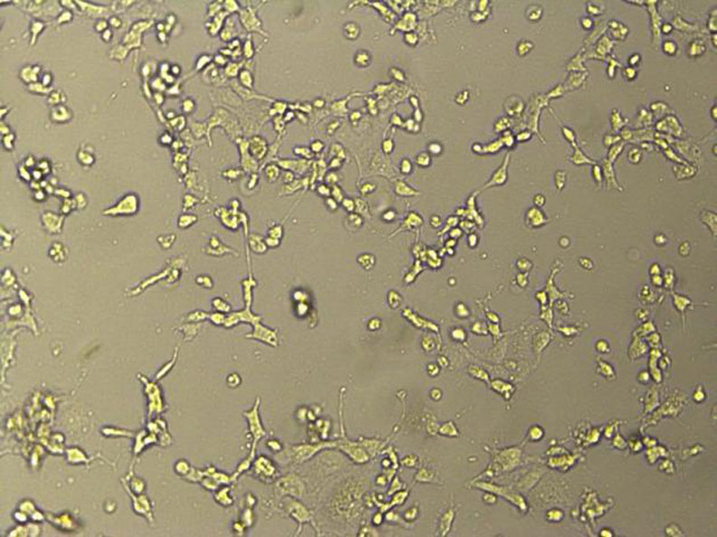 出現完全病變的vero-E6傳代細胞。取自人民網