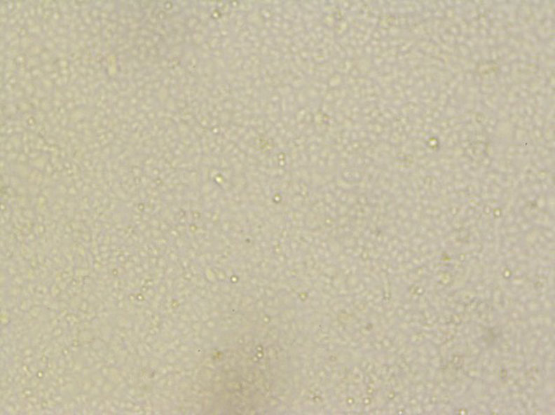 正常的vero-E6傳代細胞。取自人民網