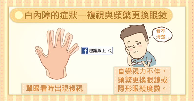 白內障的症狀——複視與頻繁更換眼鏡。
