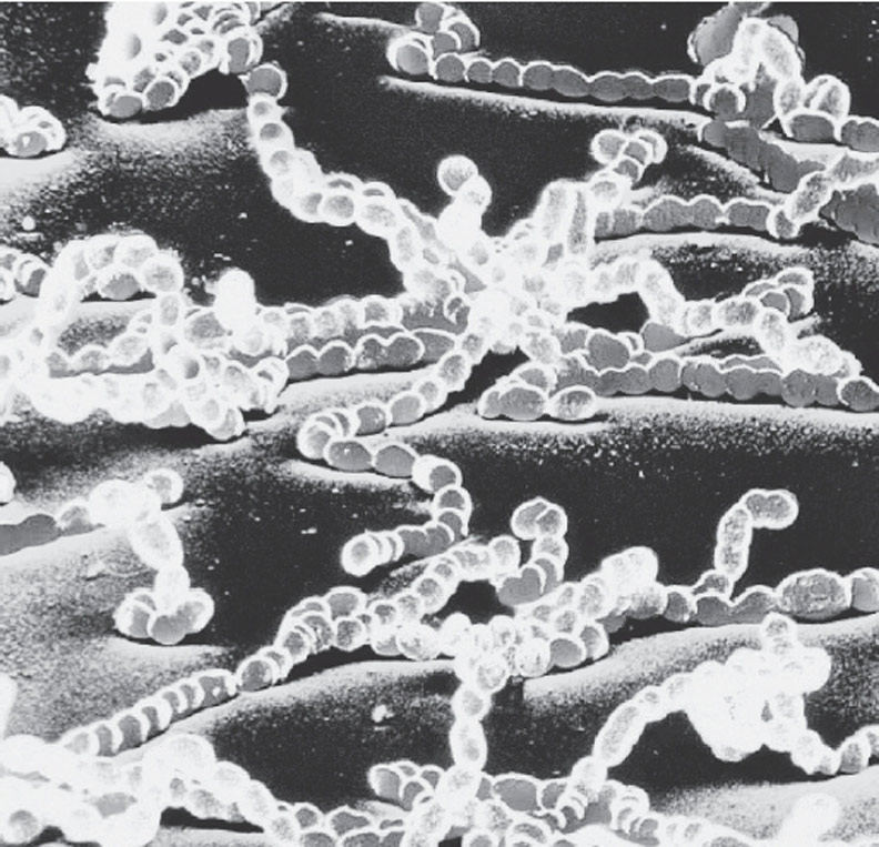 顯微鏡下的「屍體顆粒」。時報出版提供