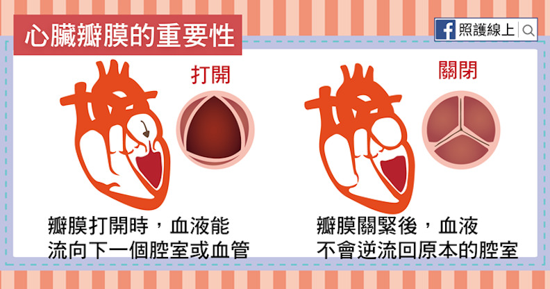 心臟瓣膜的重要性。