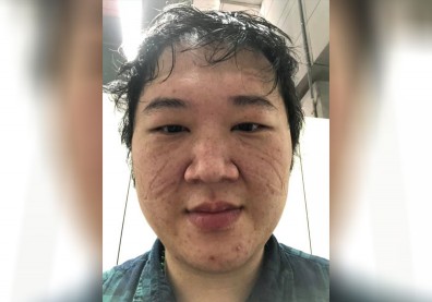 支援前線留下「負重印記」！醫師：我只是小螺絲釘