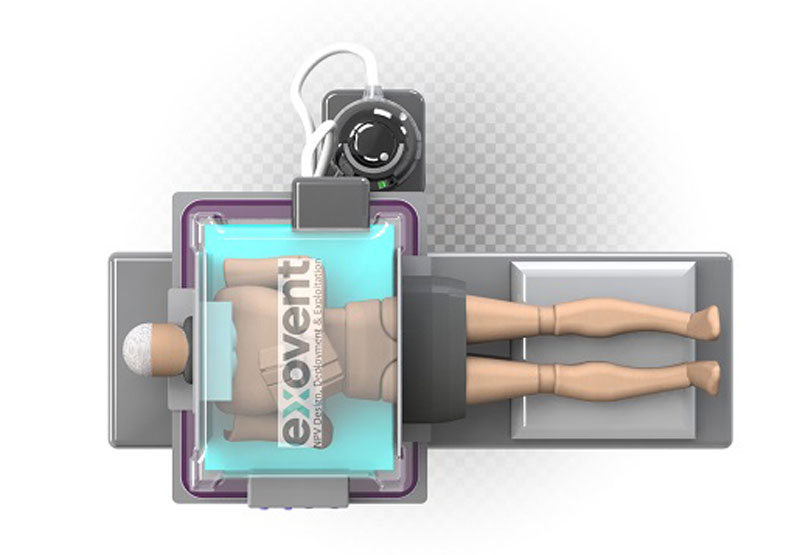 與傳統鐵肺相比，exovent 的外觀明顯更為簡潔輕便。取自@wmgwarwick twitter
