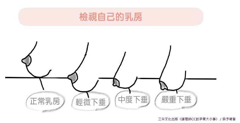 檢視自己的乳房。