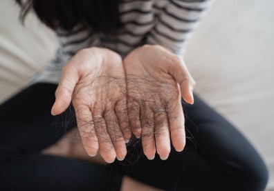 33歲女性持續焦躁、腹瀉、掉髮，確診「甲狀腺亢進」
