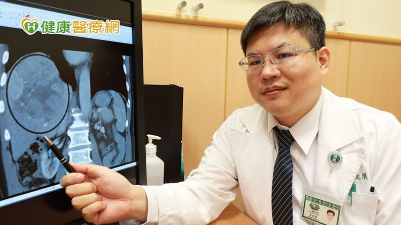 臺中慈濟醫院一般外科主任余政展說明,田先生的肝腫瘤位置達13公分;圖由臺中慈院提供。