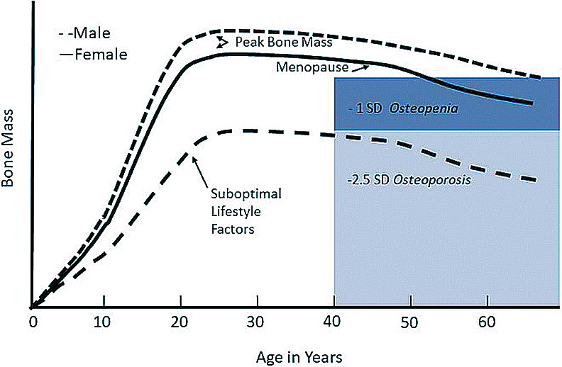 隨著年齡增加,骨質流失越多。(Evolutionary Perspectives on the Developing Skeleton and Implications for Lifelong Health (2020))