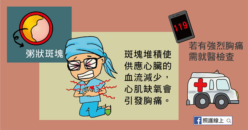 斑塊堆積使供應心臟的血流減少，心肌缺氧會引發胸痛。