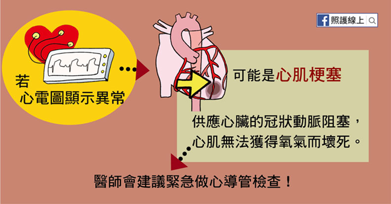 若心電圖顯示異常，可能是心肌梗塞。