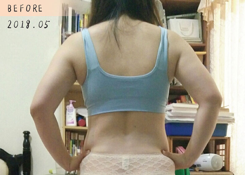 背部曲線Before。