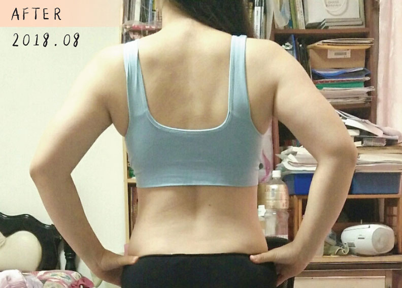 背部曲線After。