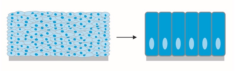 健康的食道黏膜細胞為扁平狀(左),巴瑞特氏食道病變的黏膜細胞呈柱狀。