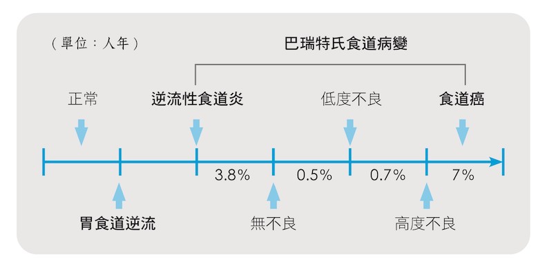 胃食道逆流只吃成藥不就醫 症狀加劇成 巴瑞特氏食道病變 閱讀 對身體好 健康遠見