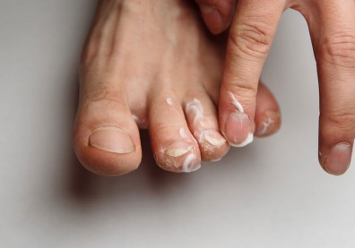 慢性病患者風險高！別輕忽小傷口，蜂窩性組織炎嚴重將致命