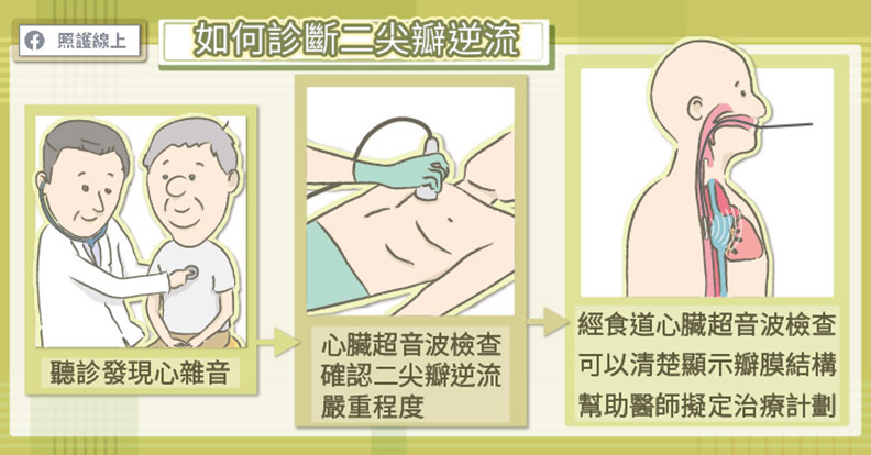 如何診斷二尖瓣逆流?