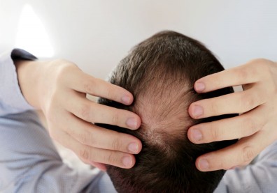 植髮能根治雄性禿嗎？皮膚科醫師帶你釐清植髮的 10 大迷思