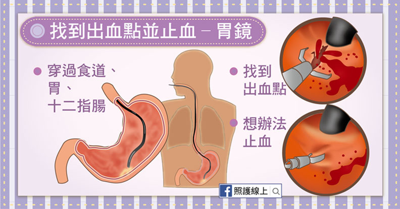找到出血點並止血。