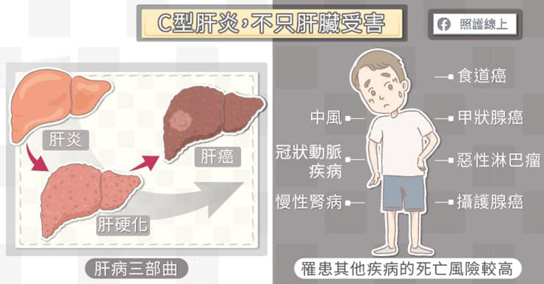 C型肝炎,不只肝臟受害。