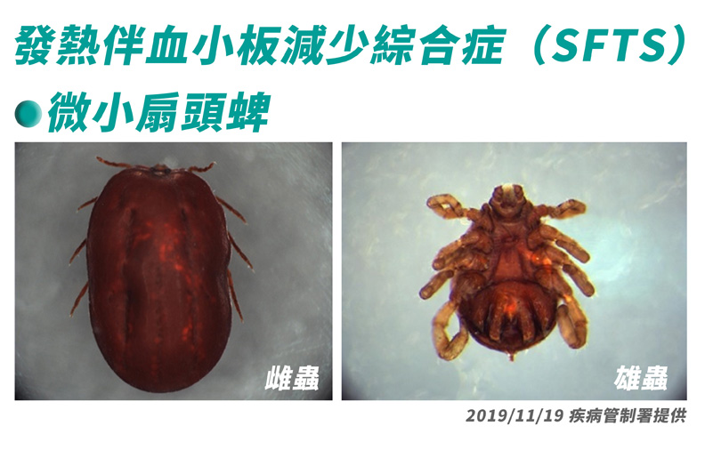 SFTS屬於蜱媒病毒感染。