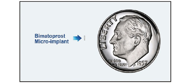 杜里斯塔植入型小藥丸和一枚美國的5分錢幣比較大小。
