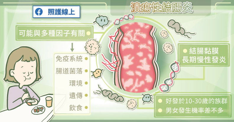 潰瘍性結腸炎可能與多種因子有關。