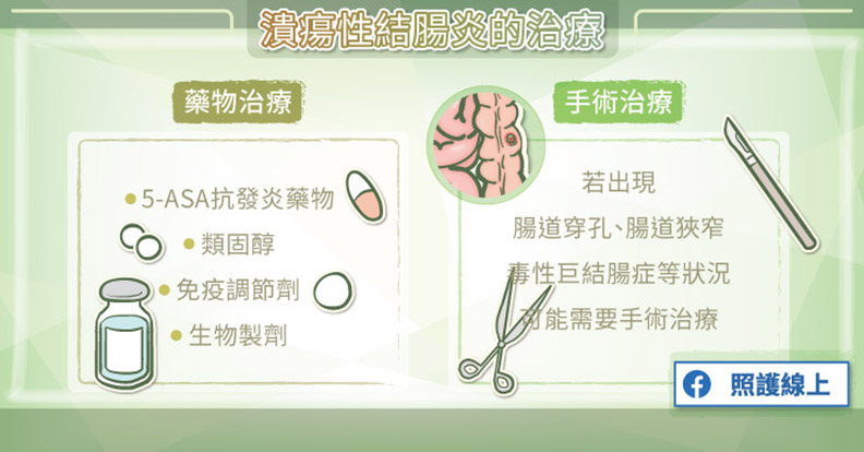 潰瘍性結腸炎的治療。