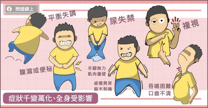 症狀千變萬化、全身受影響。