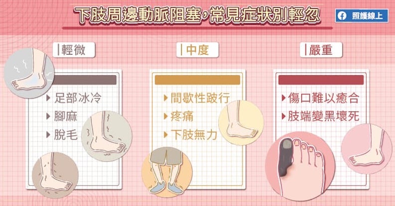 下肢周邊動脈阻塞,常見症狀別輕忽。