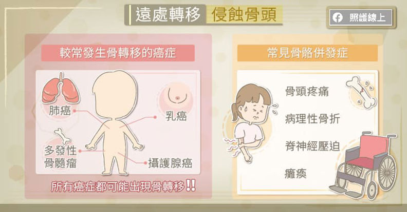 遠處轉移侵蝕骨頭。